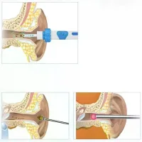 Ухочистка DEOcross C-ears TV One электрическая • Компактный прибор DEOcross C-ears TV One с мягкими сменными насадками для ухода за ушами