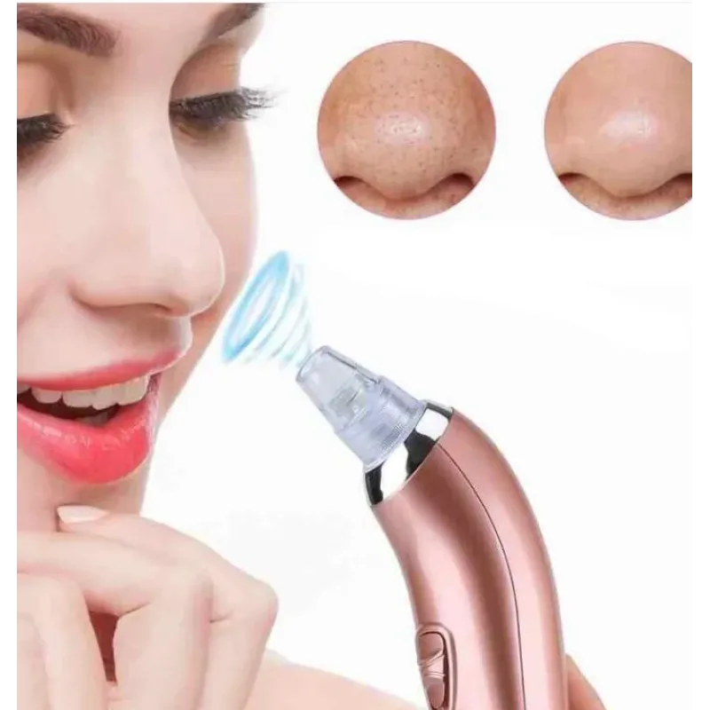 Вакуумний апарат для чищення пор Beauty Skin Care XN-8030 · Прилад для очищення пор · Апаратна чистка обличчя
