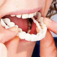 Знімні вініри для зубів Snap On Smile на 2 щелепи • Накладні вініри на верхню та нижню щелепу для красивої усмішки
